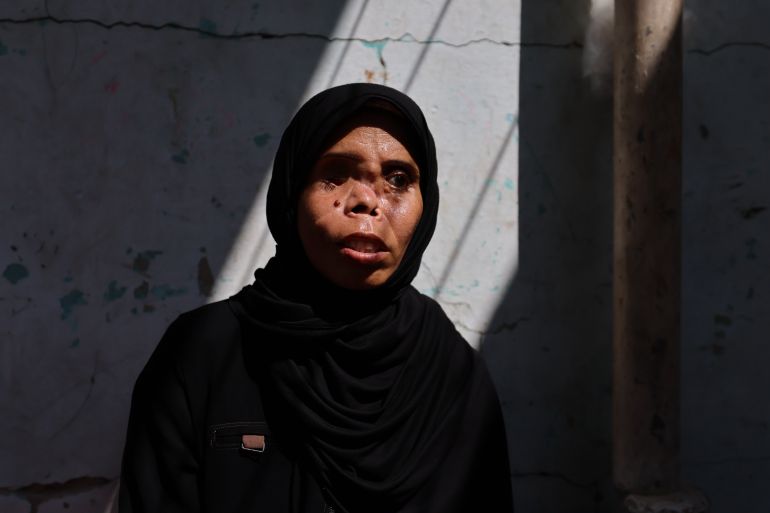 Najwa’s long recovery in Gaza after losing eye and daughter in Israeli air strike