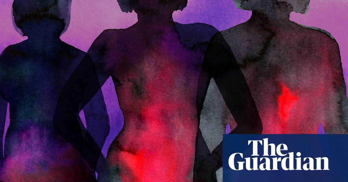 Women report severe pain during routine hysteroscopies as reform stalls