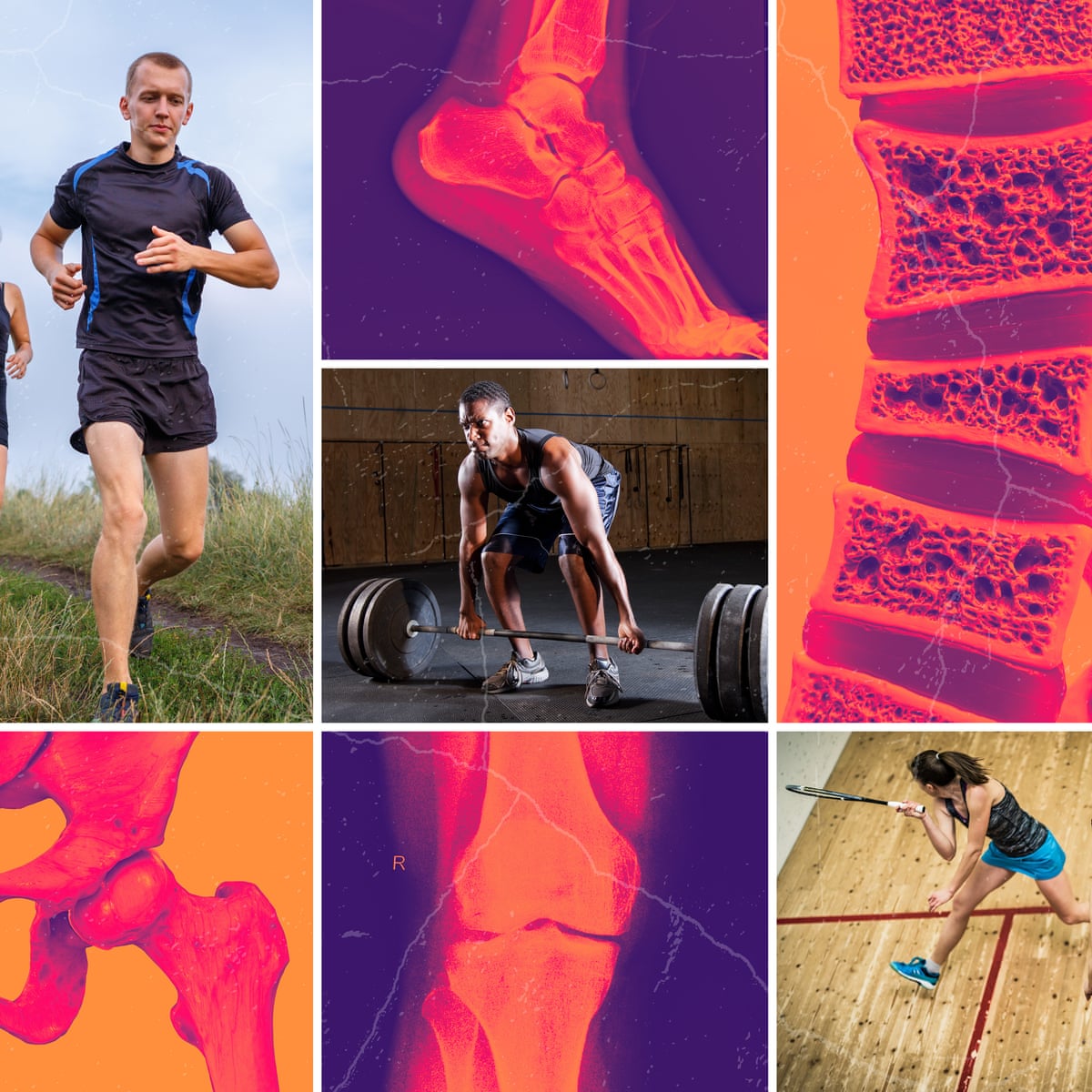 Why Many Fitness Fans End Up Needing Surgery Despite Staying Active